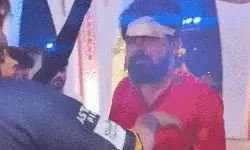 पूरण के छक्के से फैन के सिर से छूटा खून का फव्वारा- लहूलुहान प्रशंसक.. पूरण के छक्के से फैन के सिर से छूटा खून का फव्वारा- लहूलुहान प्रशंसक..