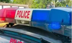 पिता के साथ जा रही युवती से पर्स लूटने वाले दो बदमाश मुठभेड़ में लंगड़े