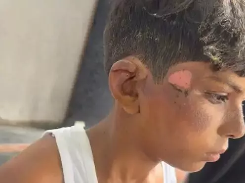 मकान के भीतर चल रहे मदरसे में ब्लॉस्ट-दर्जनों बच्चे झुलसे- हालत गंभीर मकान के भीतर चल रहे मदरसे में ब्लॉस्ट-दर्जनों बच्चे झुलसे- हालत गंभीर