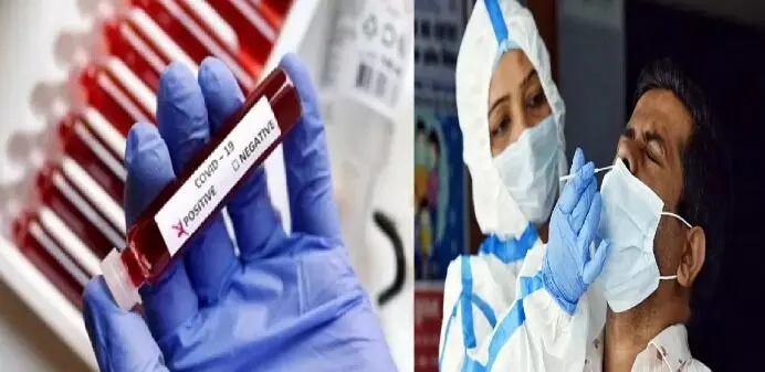 यूपी में कोरोना की वापसी- बाहर से लेकर आए संक्रमण-4 लोग पॉजिटिव यूपी में कोरोना की वापसी- बाहर से लेकर आए संक्रमण-4 लोग पॉजिटिव