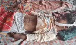 दूध लेने गई बच्ची पर कुत्तों का हमला- खा गए सिर और कान- शरीर पर नहीं.. दूध लेने गई बच्ची पर कुत्तों का हमला- खा गए सिर और कान- शरीर पर नहीं..