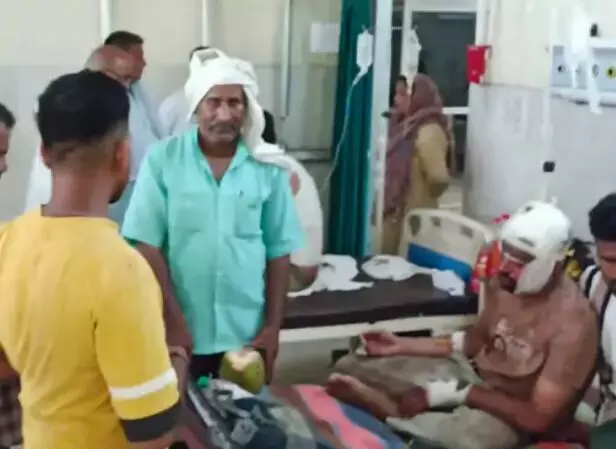 सप्लाई कर लौट रहे दूध विक्रेता पर हमला- कैन के ढक्कन से किये प्रहार सप्लाई कर लौट रहे दूध विक्रेता पर हमला- कैन के ढक्कन से किये प्रहार