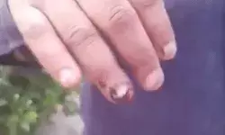 पति को ईंट मारकर बोली पत्नी- तू मेरी साबुन से क्यों नहाया? थाने से.... पति को ईंट मारकर बोली पत्नी- तू मेरी साबुन से क्यों नहाया? थाने से....