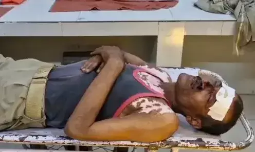 सुरक्षा ड्यूटी पर तैनात होमगार्ड को आए चक्कर-बेहोश होकर गिरे जवान को