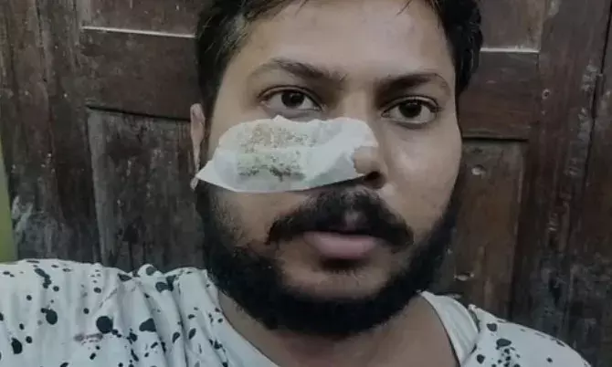 शिव शक्ति रुद्र महायज्ञ में चली गोलियां-पब्लिक ने मौके से भाग कर ...