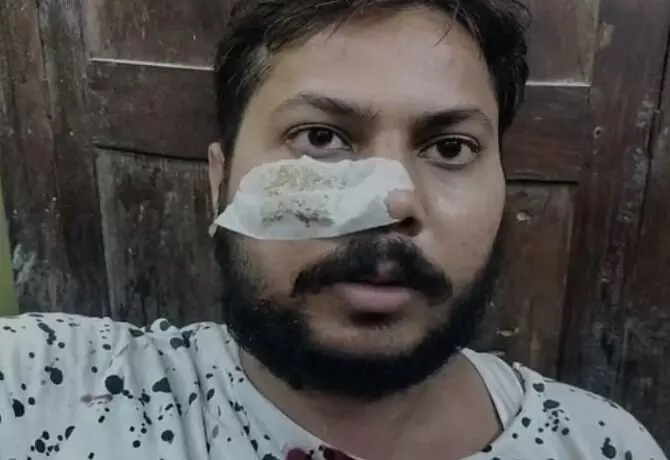 शिव शक्ति रुद्र महायज्ञ में चली गोलियां-पब्लिक ने मौके से भाग कर ...