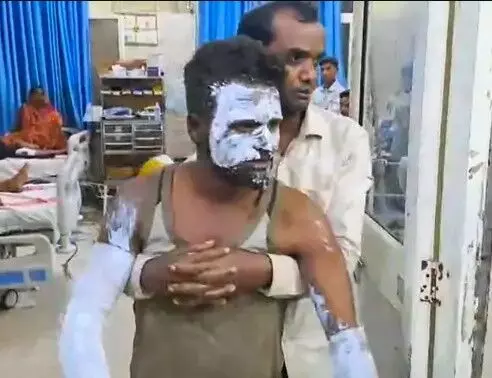 नई बैटरी लगाते ही ब्लास्ट के बाद ई रिक्शा में लगी आग- दो युवक....