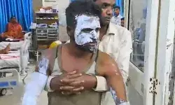 नई बैटरी लगाते ही ब्लास्ट के बाद ई रिक्शा में लगी आग- दो युवक.... नई बैटरी लगाते ही ब्लास्ट के बाद ई रिक्शा में लगी आग- दो युवक....