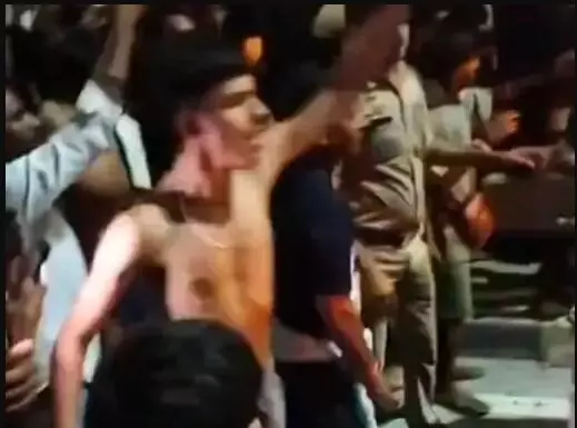 सड़क पार कर रहा युवक तेज रफ्तार कार से टकराया- लोगों ने कार को.. सड़क पार कर रहा युवक तेज रफ्तार कार से टकराया- लोगों ने कार को..