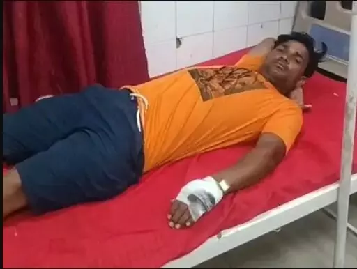 गंगाजल लेकर जा रहे शिव भक्तों पर कुत्ते का अटैक- तीन कांवड़िया घायल