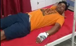 गंगाजल लेकर जा रहे शिव भक्तों पर कुत्ते का अटैक- तीन कांवड़िया घायल गंगाजल लेकर जा रहे शिव भक्तों पर कुत्ते का अटैक- तीन कांवड़िया घायल