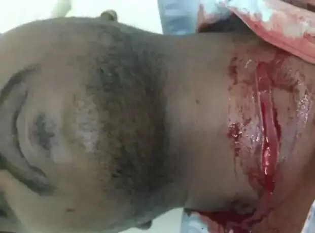 गैर समुदाय के दबंग का मजदूर पर हमला- चाकू से गला रेतकर किया मरणासन्न गैर समुदाय के दबंग का मजदूर पर हमला- चाकू से गला रेतकर किया मरणासन्न