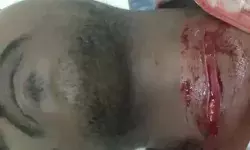 गैर समुदाय के दबंग का मजदूर पर हमला- चाकू से गला रेतकर किया मरणासन्न