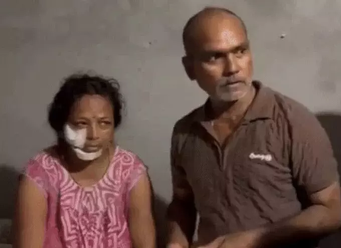 कॉलोनी में घुसे तेंदुए का फूल तोड़ रही महिला पर हमला- गाल पर..