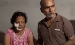 कॉलोनी में घुसे तेंदुए का फूल तोड़ रही महिला पर हमला- गाल पर.. कॉलोनी में घुसे तेंदुए का फूल तोड़ रही महिला पर हमला- गाल पर..