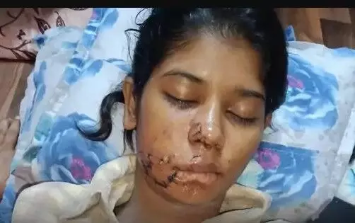 आवारा कुत्तों द्वारा नोंची गई छात्रा की होगी सर्जरी-डॉक्टर मुफ्त करेंगे आवारा कुत्तों द्वारा नोंची गई छात्रा की होगी सर्जरी-डॉक्टर मुफ्त करेंगे