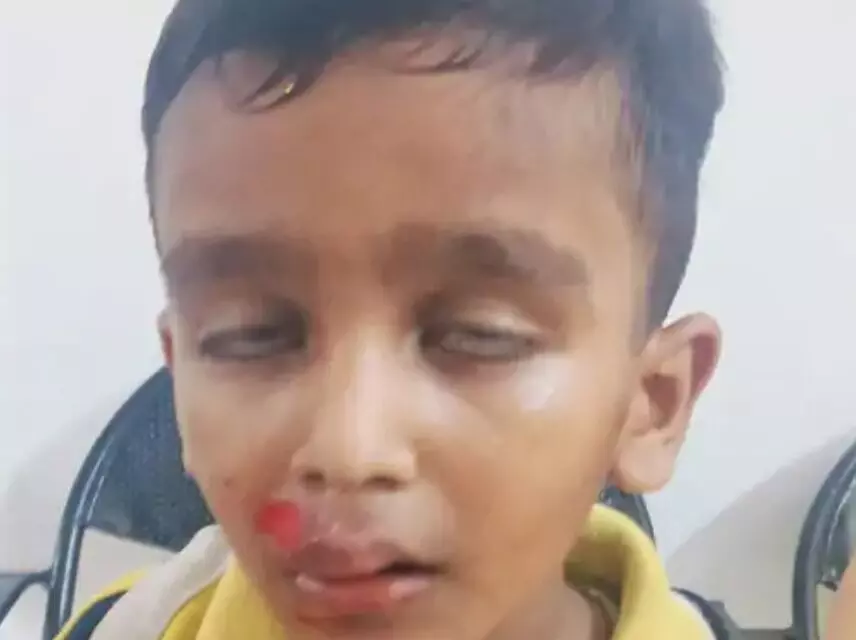 चलती स्कूल वैन का गेट खुलने से सड़क पर गिरे बच्चे- प्रबंधक ने बच्चों.. चलती स्कूल वैन का गेट खुलने से सड़क पर गिरे बच्चे- प्रबंधक ने बच्चों..