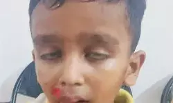 चलती स्कूल वैन का गेट खुलने से सड़क पर गिरे बच्चे- प्रबंधक ने बच्चों.. चलती स्कूल वैन का गेट खुलने से सड़क पर गिरे बच्चे- प्रबंधक ने बच्चों..