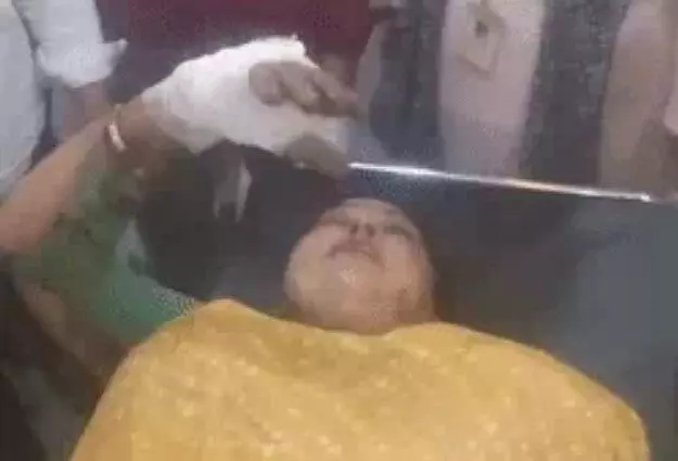 ड्यूटी जा रही नर्स पर एसिड अटैक- बुरी तरह से झुलसी- आरोपी की..