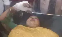 ड्यूटी जा रही नर्स पर एसिड अटैक- बुरी तरह से झुलसी- आरोपी की.. ड्यूटी जा रही नर्स पर एसिड अटैक- बुरी तरह से झुलसी- आरोपी की..