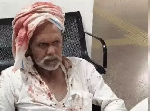 दो पक्षों में खूनी संघर्ष- लाठी डंडे लेकर घर में घुसे- मकान की छत से..