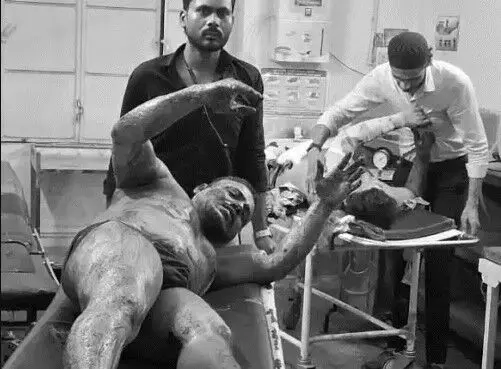मस्जिद के पास स्कूटियों में ब्लास्ट-दुकानों की दीवारें चटकी- मची भगदड़