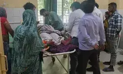 खाना बनाते समय गैस सिलेंडर में लीकेज- आग में झुलसी महिला हायर सेंटर..