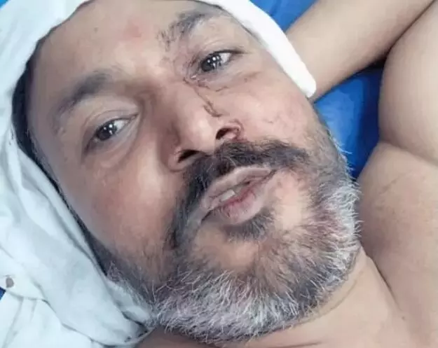 पटाखा फोड़ने के विवाद में अधिवक्ता को किया लहूलुहान- सिर में मारी गोली पटाखा फोड़ने के विवाद में अधिवक्ता को किया लहूलुहान- सिर में मारी गोली