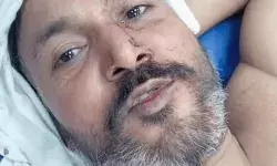 पटाखा फोड़ने के विवाद में अधिवक्ता को किया लहूलुहान- सिर में मारी गोली