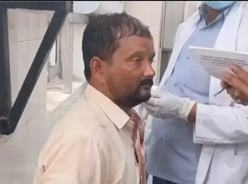 बाइक टक्कर विवाद में जिला पंचायत सदस्य पति की कुटाई-फोडा सिर बाइक टक्कर विवाद में जिला पंचायत सदस्य पति की कुटाई-फोडा सिर