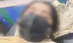 राजधानी में DU की छात्रा पर एसिड अटैक- बुरी तरह झुलसे दोनों हाथ