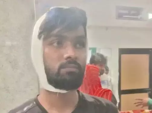 AMU में कलमा नहीं पढने पर स्टूडेंट की कुटाई- पिस्टल की बट मारकर किया.. AMU में कलमा नहीं पढने पर स्टूडेंट की कुटाई- पिस्टल की बट मारकर किया..