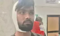 AMU में कलमा नहीं पढने पर स्टूडेंट की कुटाई- पिस्टल की बट मारकर किया.. AMU में कलमा नहीं पढने पर स्टूडेंट की कुटाई- पिस्टल की बट मारकर किया..