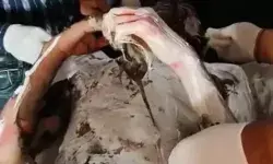 फीस जमा नहीं होने पर परीक्षा देने से रोका- छात्र ने खुद को लगाई आग