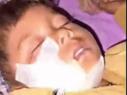 पेड़ के नीचे सियार का मासूम पर हमला- जबा गया एक तरफ का गाल पेड़ के नीचे सियार का मासूम पर हमला- जबा गया एक तरफ का गाल