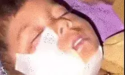 पेड़ के नीचे सियार का मासूम पर हमला- जबा गया एक तरफ का गाल पेड़ के नीचे सियार का मासूम पर हमला- जबा गया एक तरफ का गाल