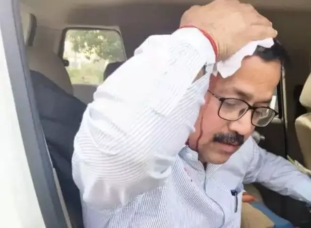 बुलडोजर लेकर पहुंचे नायब तहसीलदार पर हमला- पत्थर मार फोड़ा सिर