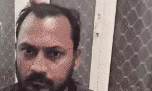 स्कूटी सवार के सिर में घोंपा सुआ- पैदल चलकर पहुंच हॉस्पिटल स्कूटी सवार के सिर में घोंपा सुआ- पैदल चलकर पहुंच हॉस्पिटल