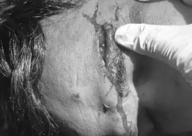 पैदल जा रहे परिवार पर चढ़ी बेकाबू कार-पति पत्नी व बेटा गंभीर