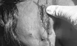 पैदल जा रहे परिवार पर चढ़ी बेकाबू कार-पति पत्नी व बेटा गंभीर