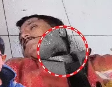 चाइनीज मांझा ले उड़ा बाइक सवार टीचर की जान- गर्दन काटने से मौत चाइनीज मांझा ले उड़ा बाइक सवार टीचर की जान- गर्दन काटने से मौत