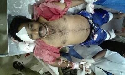 केरल में एक और राष्ट्रीय स्वयंसेवक संघ कार्यकर्ता पर जानलेवा हमला