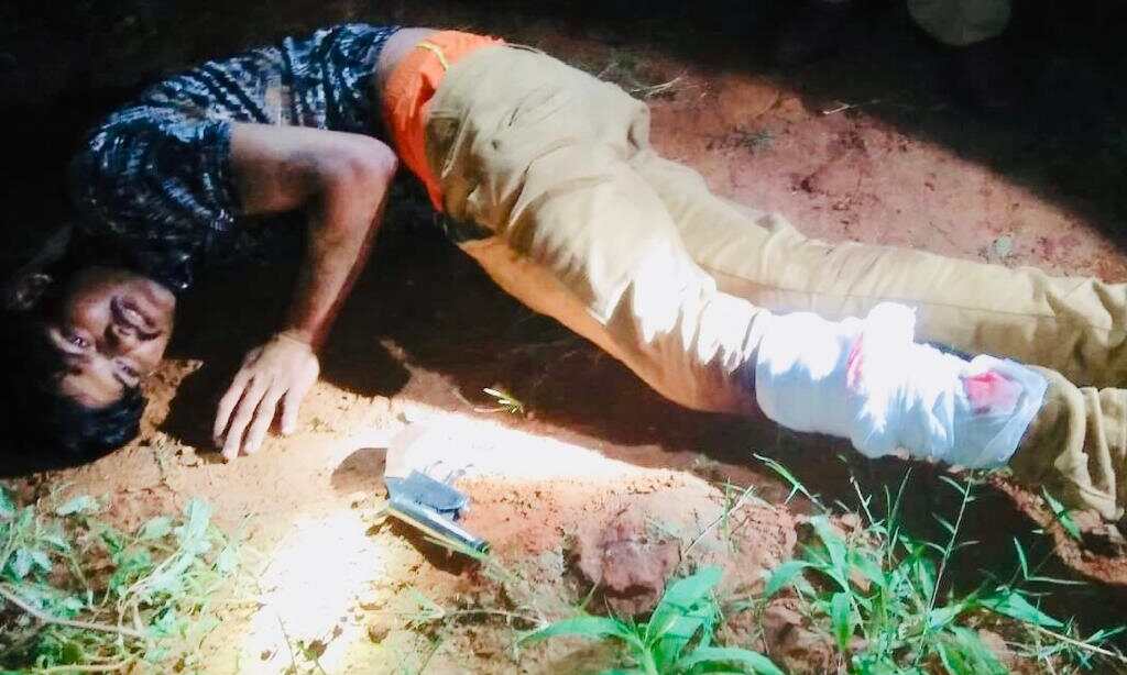 शामली पुलिस ने मुठभेड़ के बाद अपराधी को लंगड़ा करके दबोचा