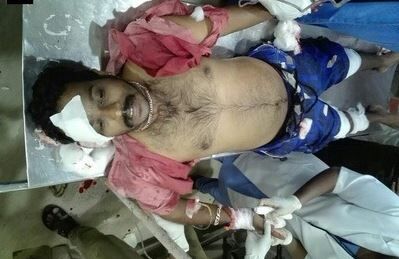 केरल में एक और राष्ट्रीय स्वयंसेवक संघ कार्यकर्ता पर जानलेवा हमला