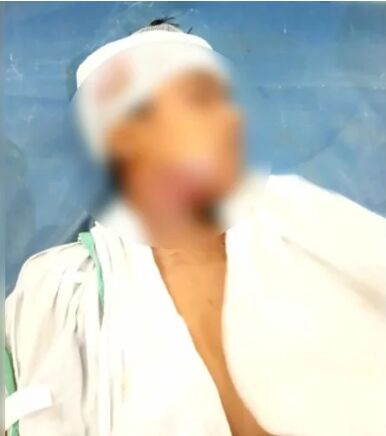 शादी के मंडप में युवक पर जानलेवा हमला