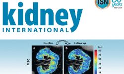 गुर्दे के मरीजों को COVID-19 कोरोना वायरस के इंफेक्शन का ज्यादा खतरा गुर्दे के मरीजों को COVID-19 कोरोना वायरस के इंफेक्शन का ज्यादा खतरा